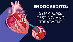 Heart Valve Infection Treatment at Livasa Mohali - Endocarditis Care